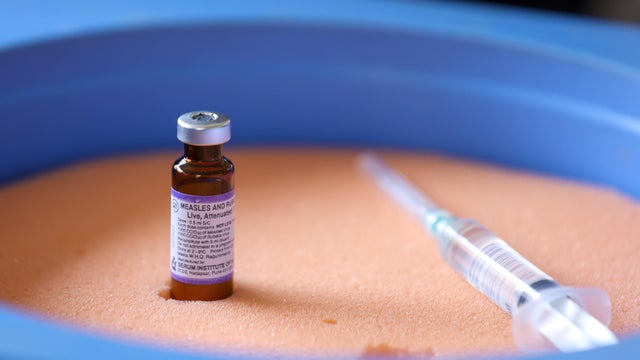 Vaccination Campaign Against Measles- Rubella Launched In Nepal 